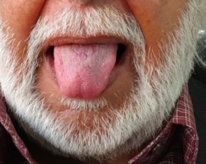 The Tongue: A small power that can change lives