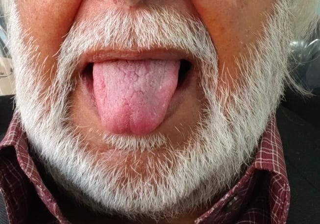 The Tongue: A small power that can change lives